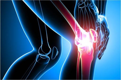 GENU LIGAFLEX ROM est une genouillère indiquée dans la prise en charge des ruptures des ligaments croisés et des entorses moyennes ou graves des ligaments latéraux (illustration).
