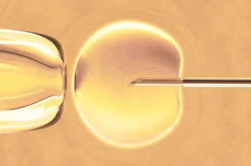 Les dons de sperme et/ou d'ovules sont utilisés pour réaliser des fécondations in vitro (illustration). 