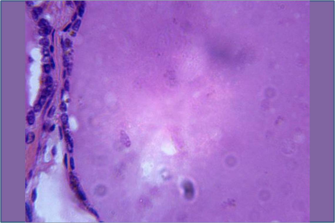 Glande thyroïde (coupe histologique, cliché microscopique)