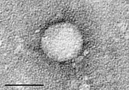Micrographie du virus de l'hépatite C. Échelle = 50 nanomètres (© MT Catanese, M Kopp, K Uryu et C Rice. Wikimedia).