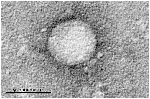 Virus de l'hépatite C purifié à partir d'une culture cellulaire, en microscopie électronique (illustration @ Wikimedia).