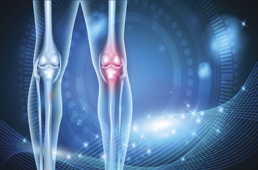 <p>HYMOVIS est indiqué dans le traitement des douleurs liées l'arthrose et dans le traitement conservateur des lésions méniscales du genou (illustration).</p>