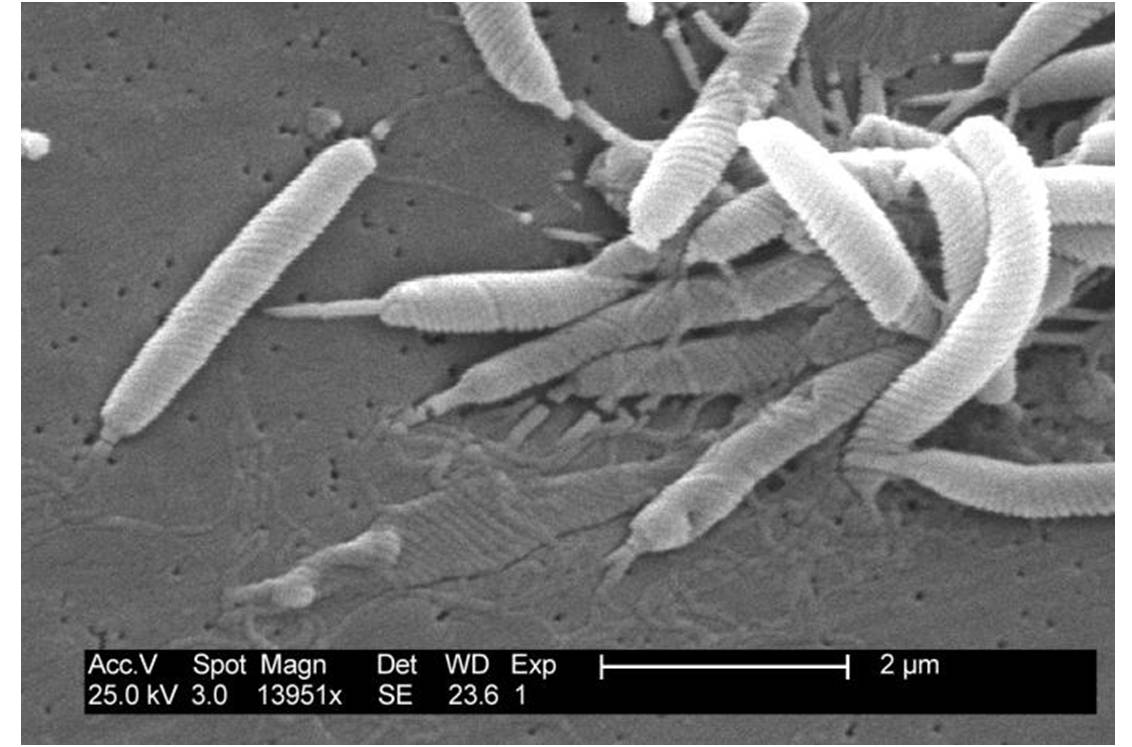 Helicobacter pylori (Crédit photo : Janice Carr ; auteurs : Drs P. Fields et C. Fitzgerald ; @ Wikimedia).