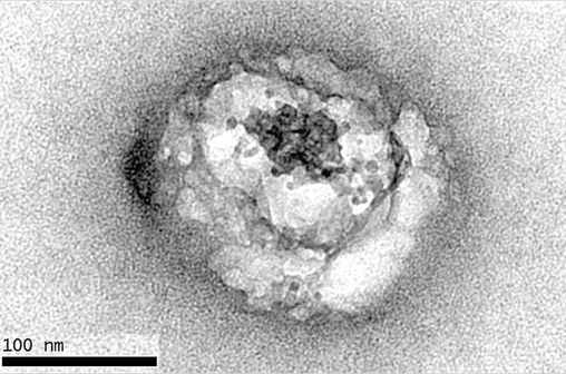 Voici la première photographie du virus de l'hépatite C, hybridé avec des lipides (© Inserm).