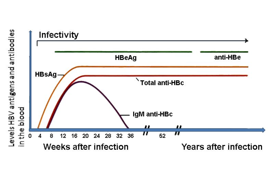 Antigènes et anticorps de l’hépatite B détectables dans le sang pendant une infection chronique (© Tim Vickers, Wikimedia)