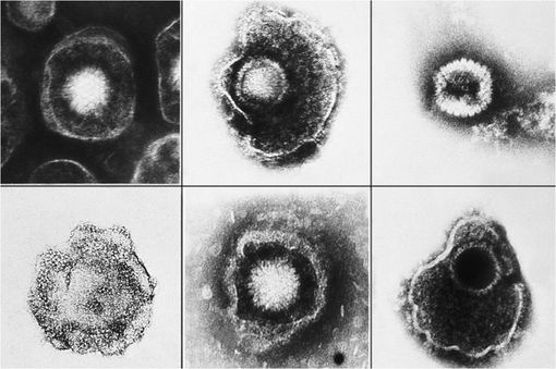 Différents Herpès virus (clichés @ CDC/ E. L. Palmer - Wikimedia).
