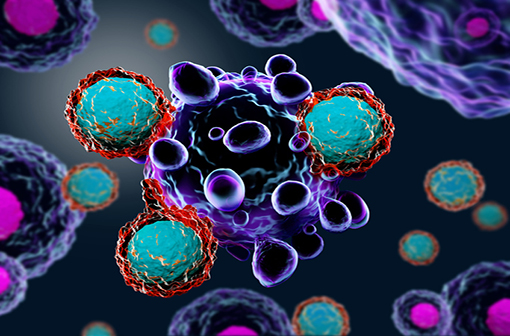 Le test Immunoscore prédit la progression du cancer du côlon en mesurant la présence de lymphocytes CD3 et CD8 cytotoxiques dans et autour de la tumeur (illustration).