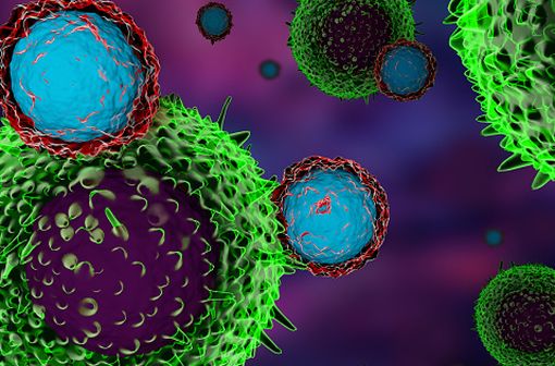 Attaque d'une cellule cancéreuse (en vert) par deux lymphocytes T (en bleu) modifiés par une immunothérapie (illustration numérique). 