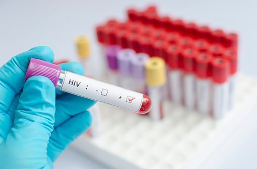 KALETRA solution buvable est indiqué en association avec d’autres médicaments antirétroviraux pour le traitement des adultes, des adolescents et des enfants âgés de 14 jours et plus, infectés par le VIH-1 (illustration).