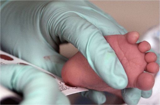 Test de Guthrie sur un nouveau né de 2 semaines permettant de détecter une phénylcétonurie (illustration @U.S. Air Force/Staff Sgt Eric T. Sheler, sur Wikimedia).