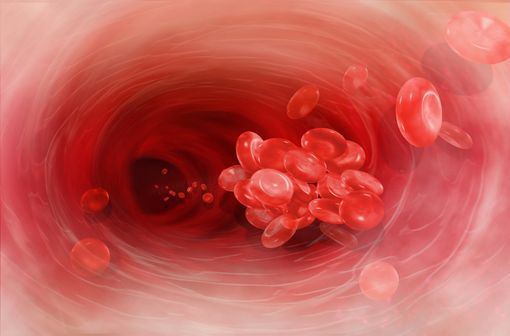 Représentation en 3D d'un caillot circulant dans un vaisseau sanguin (illustration).