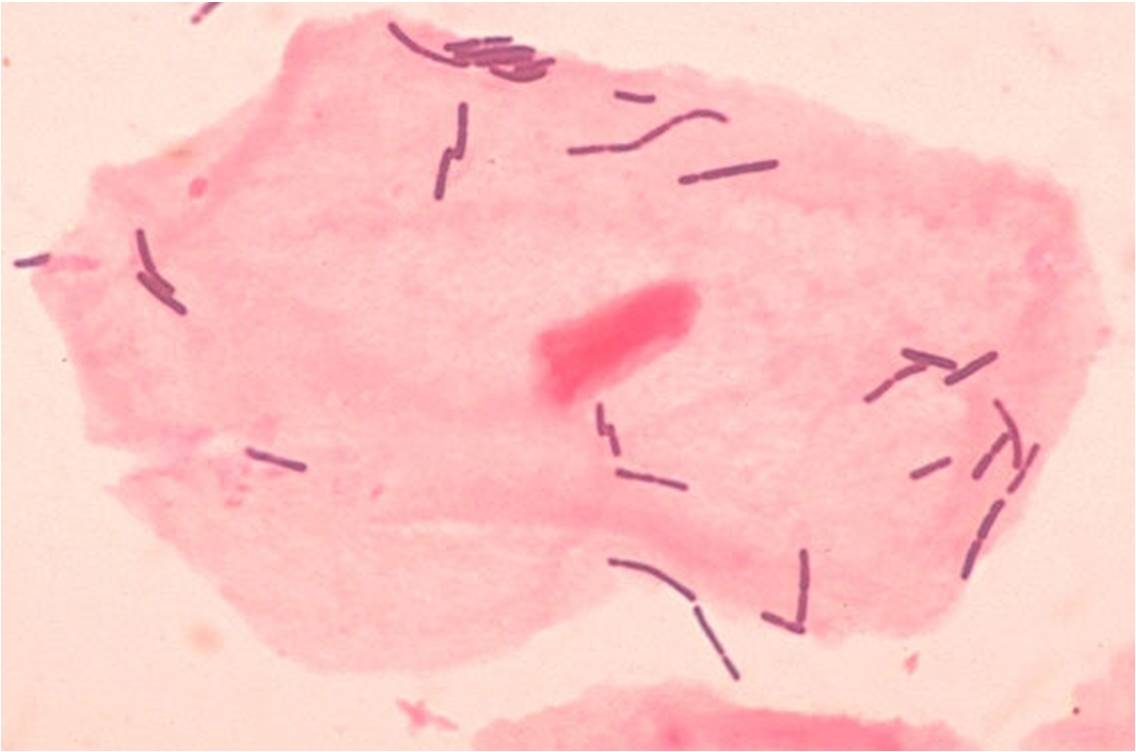 Lactobacillus acidophilus sur des squames de cellules épithéliales du vagin (@ Dr Mike Miller / CDC, Wikimedia).