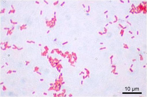 Exemple de bacilles à Gram négatif : Escherichia coli (@Y. Tambe sur Wikimedia)