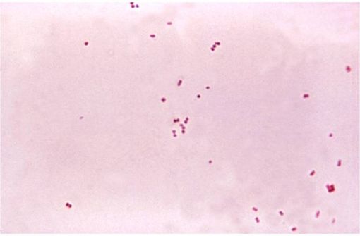 Neisseria meningitidis est une bactérie diplocoque à gram négatif connue pour son rôle dans les méningites (photo @ Dr Brodsky sur Wikimedia).