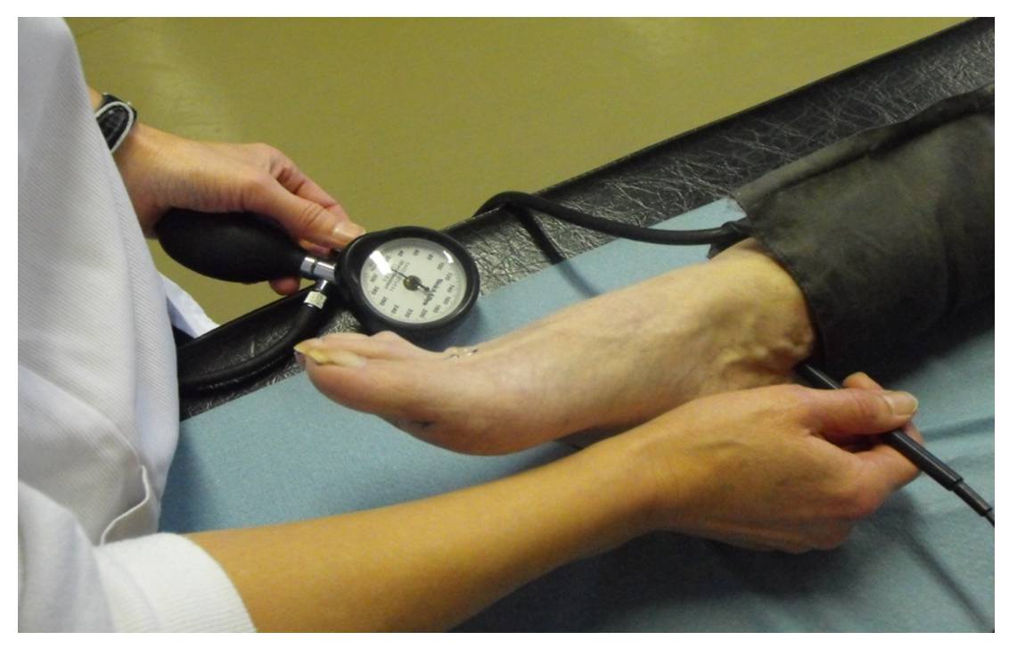 L'Indice de pression systolique (PAS cheville/PAS humérale) permet le diagnostic d'AOMI 9 fois sur 10 (image : © Dr Y. Théodose).