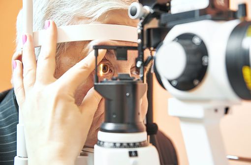 Le glaucome est souvent associée à une pression intra-oculaire élevée qui comprime et endommage les fibres du nerf optique et de la rétine (illustration)