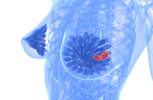 PIQRAY est un nouvel antinéoplasique indiqué dans la prise en charge de certains cancers du sein (illustration).