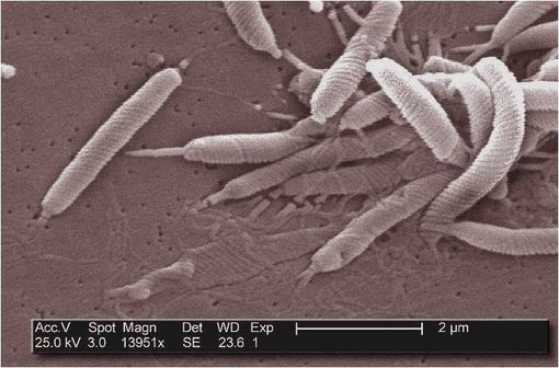 Helicobacter pylori au microscope électronique (illustration @Janice Carr sur Wikimedia).