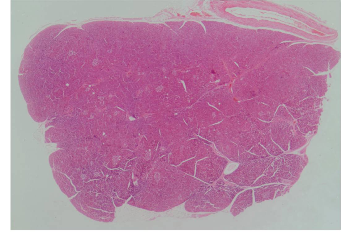 Coupe histologique de pancreas en vue microscopique.