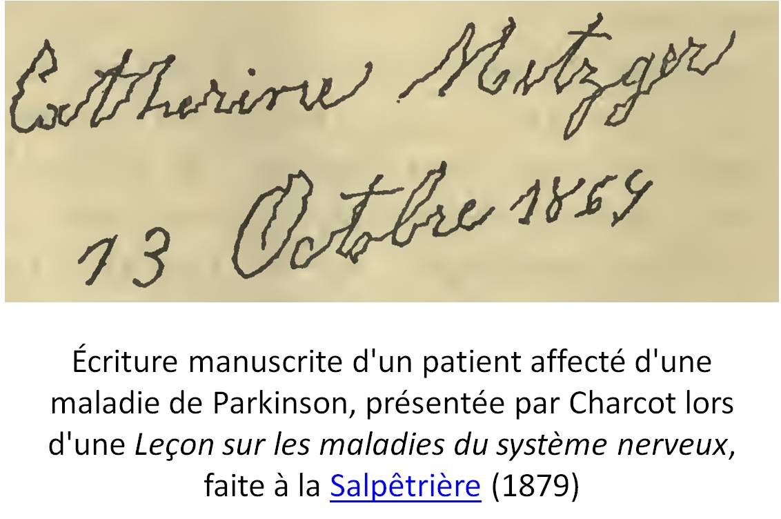 Extrait de Lectures on the diseases of the nervous system. Published 1879. Second edition. by H. C. Lea in Philadelphia . Lecture V: On paralysis agitans. Page112. Auteur : Jean-Martin Charcot (illustration @ Wikimedia)