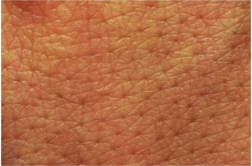 Photo rapprochée de peau humaine (@ Wikimedia).