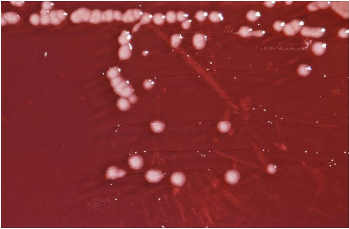 Pseudomonas aeruginosa est une bactérie gram-négative du genre Pseudomonas (cliché @ CDC, Wikimedia)