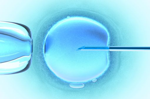 Lors d’une fécondation in vitro avec ICSI (IntraCytoplasmic Sperm Injection), un spermatozoïde est injecté dans le cytoplasme de chaque ovocyte fécondable (illustration).