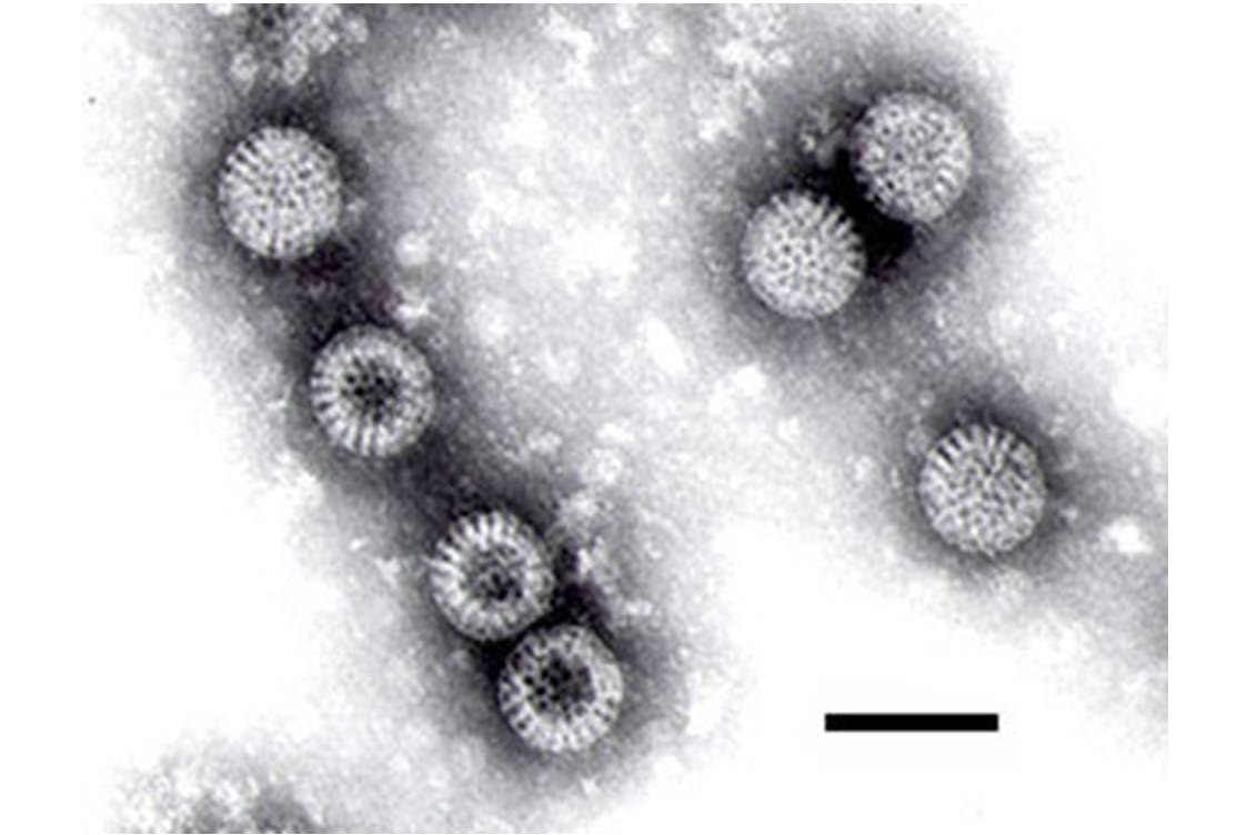 Les rotavirus sont la 1re cause de diarrhée aiguë sévère du jeune enfant dans le monde  (image : @ F.P. Williams, U.S. EPA, Wikimedia).