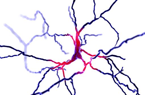 La dégénérescence des neurones dopaminergiques (ici représentés en 3D) dans la pars compacta du locus niger induit les principaux symptômes de la maladie de Parkinson (illustration). width=