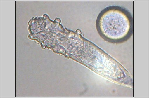 Demodex folliculorum, acarien habituel des follicules du visage, potentiellement impliqué dans la physiopathologie de la rosacée (illustration @Wikimedia).