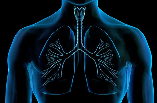 La BPCO se définit comme une maladie chronique inflammatoire, lentement progressive atteignant les bronches et caractérisée par une diminution non complètement réversible des débits aériens (illustration).
