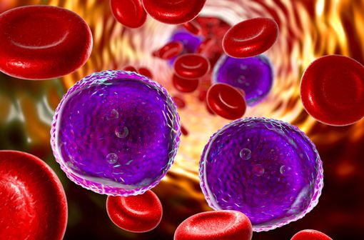 Représentation 3D de lymphoblastes dans le sang circulant, dans un contexte de leucémie aiguë lymphoblastique (illustration).
