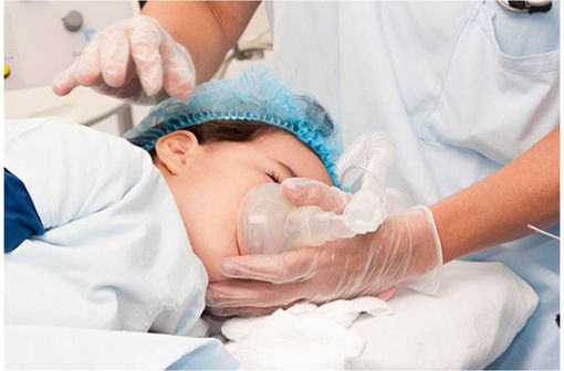 Anesthésie générale chez un enfant de plus de 1 an (illustration).