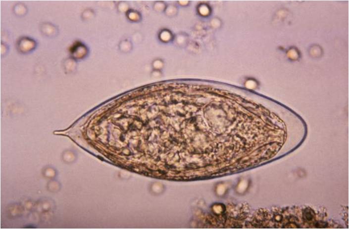 Œuf de Schistosoma haematobium (cliché @Wikimedia).