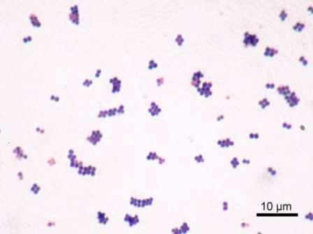 Photographie au microscope optique de bactéries Staphylococcus aureus (image : © Y. Tambe, Wikimedia).