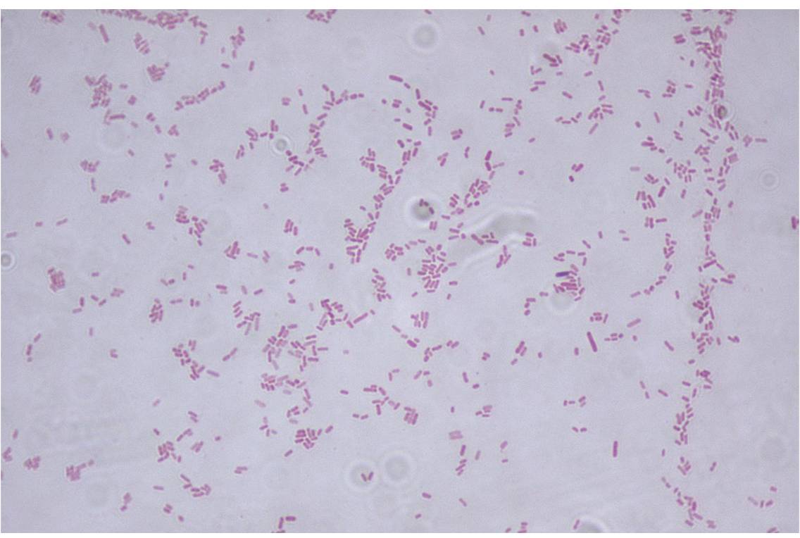 Les sténotropomones (Stenotrophomonas) sont un genre de protéobactéries (à Gram négatif), aérobies et présentant une multirésistance naturelle aux antibiotiques (cliché @ Riraq25, Wikimedia).