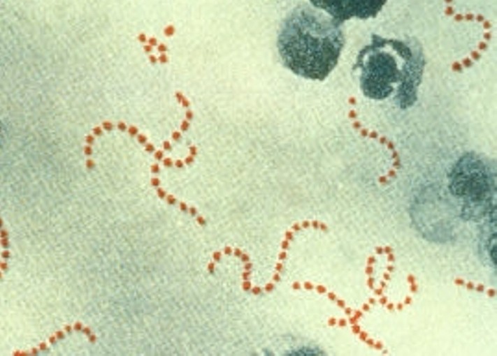 Photographie au microscope de bactéries Streptococcus pyogènes (© Wikimedia).