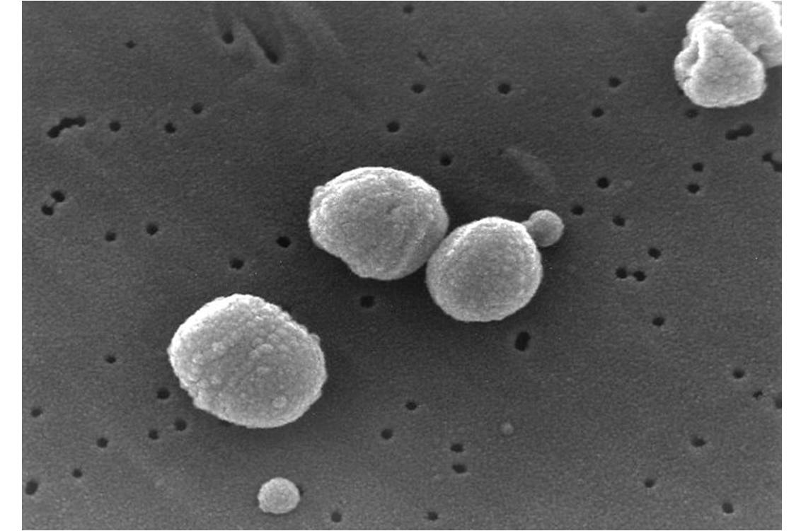 Photographie au microscope de bactéries Streptococcus pneumoniae (@Wikimedia)