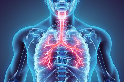 Le cancer bronchique non à petites cellules représente le type de cancer du poumon le plus fréquent, de l'ordre de 85 à 90 % de l'ensemble des cancers du poumon (illustration).
