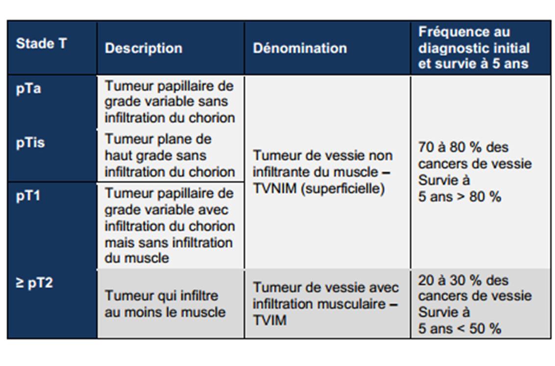Classification des tumeurs de vessie. Tableau extrait du Guide ALD 30 « Cancer de la vessie », HAS/INCa mai 2010.