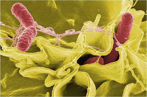 Le germe le plus souvent responsable de typhoïde est Salmonella typhi (illustration @Wikimedia).