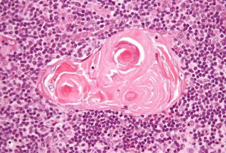 Corpuscule thymique (© 2011 Nephron, Wikimedia).