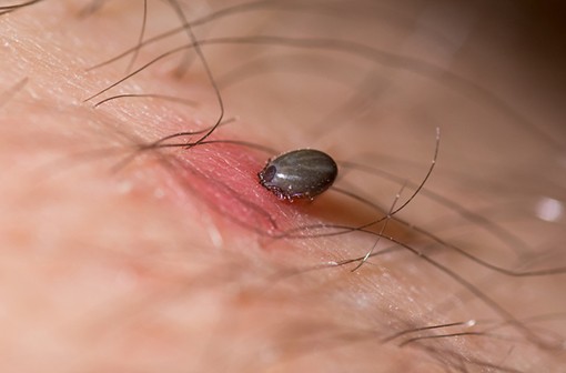 Un plan national de lutte contre la maladie de Lyme et les maladies transmises par les tiques