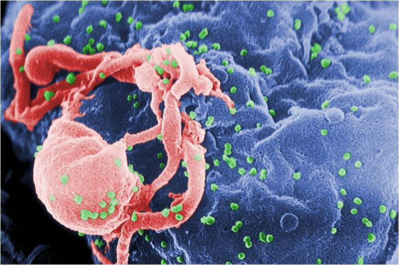 Virus HIV fixés sur un lymphocyte (le VIH est coloré en vert) [photo @ C. Goldsmith, Wikimedia].