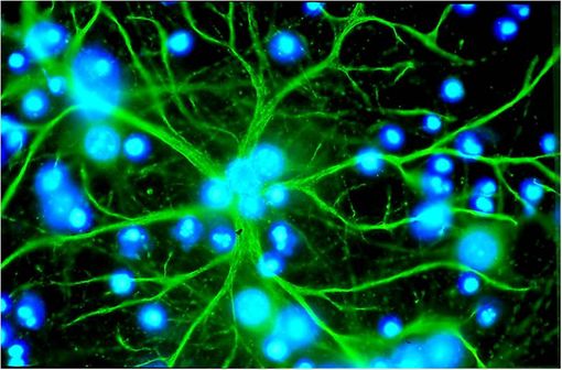 Cellules gliales du système nerveux central, les astrocytes assurent des fonctions centrées sur le support et la protection des neurones (illustration @Lka sur Wikimedia).