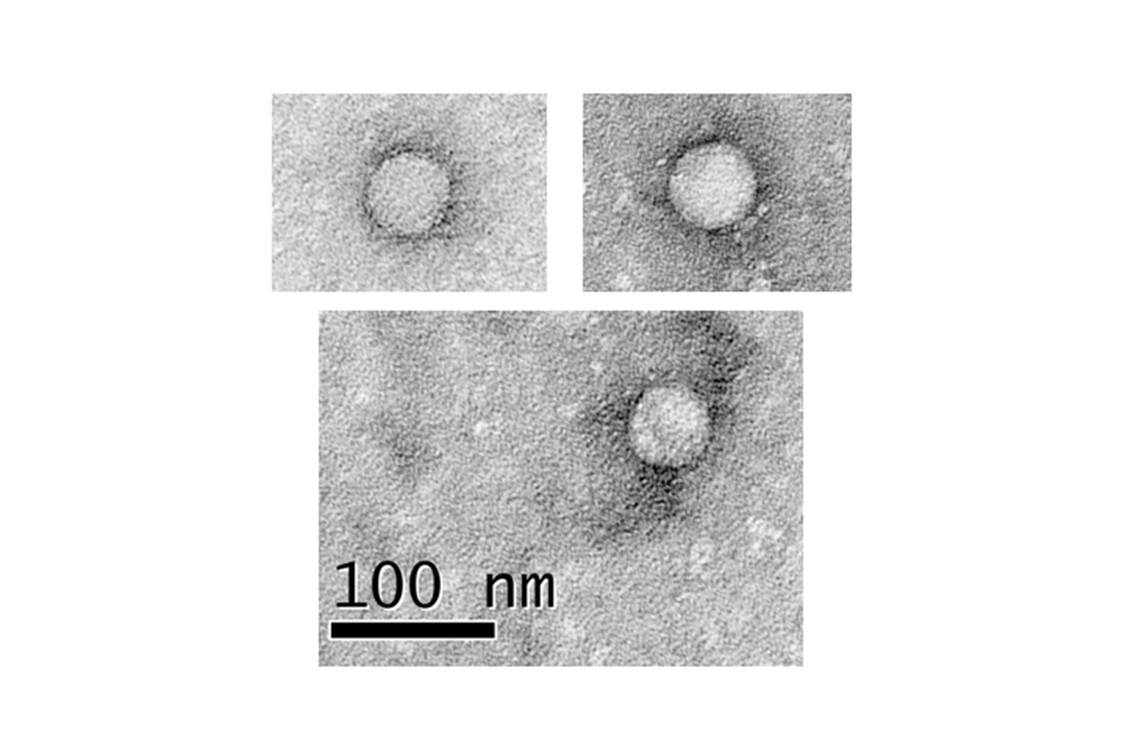Virus de l’hépatite C en microscopie électronique (image : @ MT Catanese, M Kopp, K Uryu et C Rice, Wikimedia)
