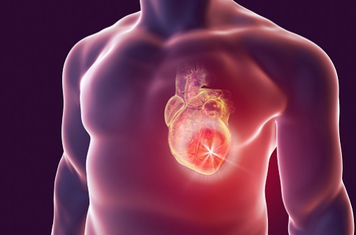 XYLOCARD est indiqué dans le traitement et la prévention des récidives des troubles du rythme ventriculaire menaçant le pronostic vital, notamment à la phase aiguë de l'infarctus du myocarde (illustration).