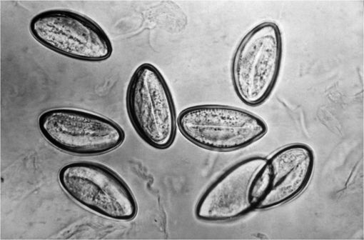 Image d'œufs d'oxyures sur cellulose à fort grossissement (illustration @DPDx, PHIL sur Wikimedia).