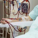 patient dialysé