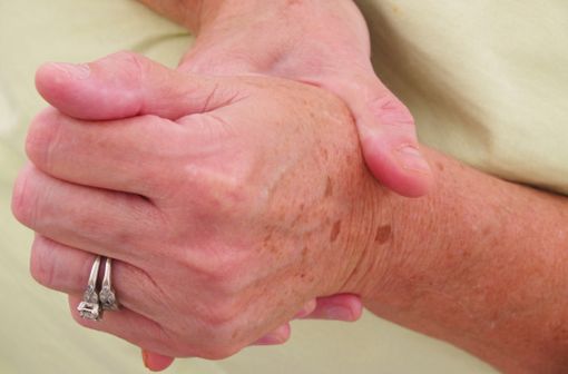 L'arthrose se manifeste par une gêne et des douleurs articulaires pouvant devenir handicapantes.